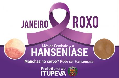 Janeiro Roxo: encontros nas Unidades de Saúde orientam população sobre a hanseníase