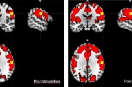 Realidade virtual é aplicada à recuperação de pacientes com doenças neurodegenerativas